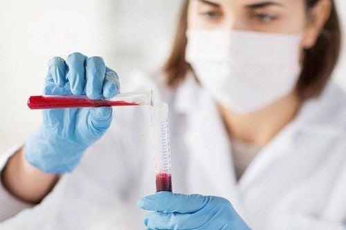 Anti HBe là gì? Chỉ số Anti HBe có ý nghĩa gì trong xét nghiệm viêm gan B?