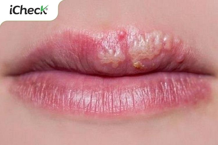 Chia sẻ 5 cách phân biệt Vaseline thật giả nhanh chóng