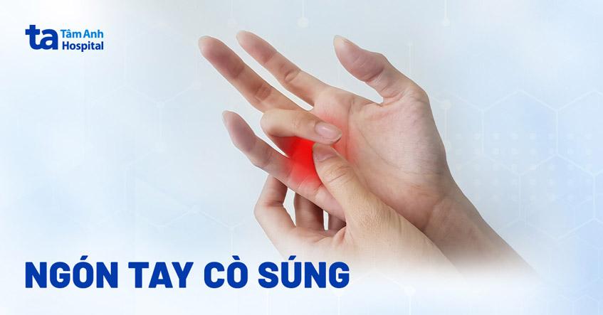 Ngón tay cò súng: Nguyên nhân, dấu hiệu, chẩn đoán, phòng ngừa
