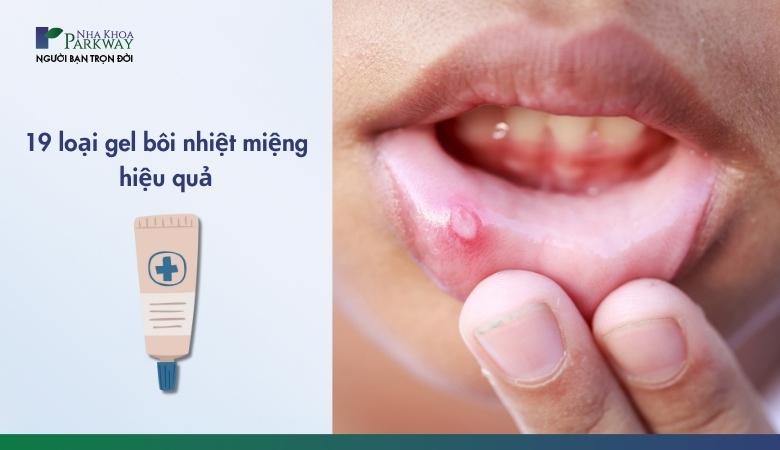 Top 19 thuốc bôi nhiệt miệng giúp khắc phục tình trạng lỡ miệng hiệu quả